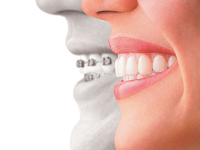 The image shows a split composition with a man s face on the left side and a woman s smiling mouth on the right, both halves connected by a transparent bridge that spans from one side of the face to the other.