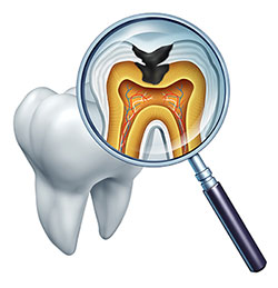 Mountain View Dentistry | Dental Sealants, Digital Radiography and Invisalign reg 