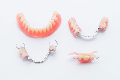 Mountain View Dentistry | Oral Cancer Screening, Implant Restorations and Fluoride Treatment