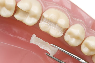 Mountain View Dentistry | Dentures, Oral Exams and Teeth Whitening