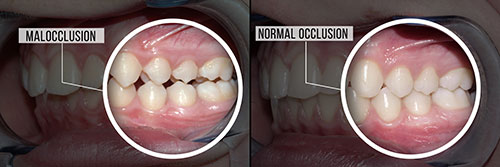 Mountain View Dentistry | Digital Radiography, Cosmetic Dentistry and Intraoral Camera