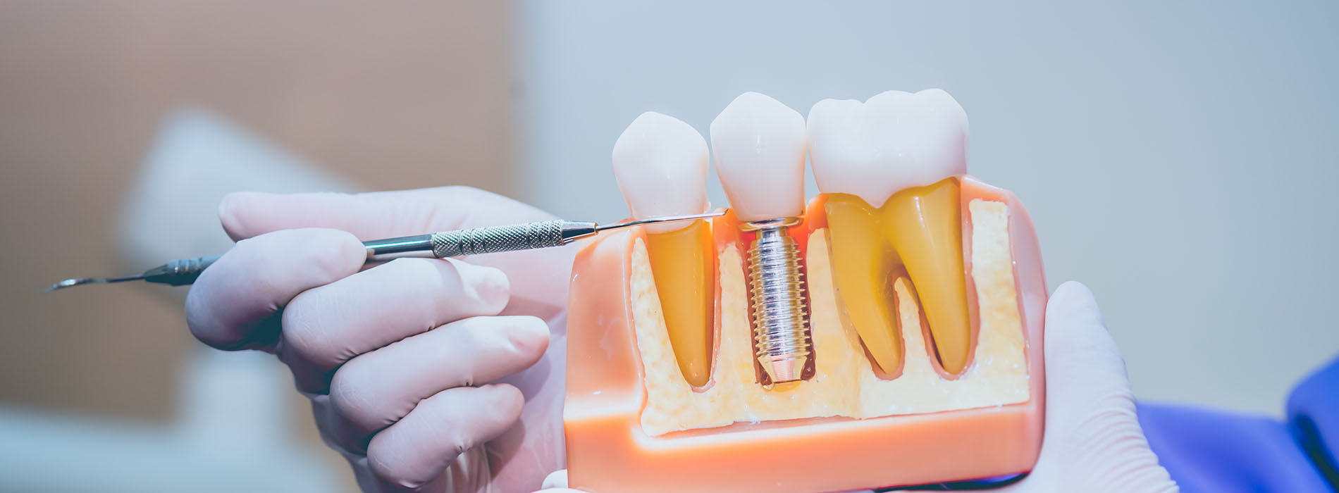 The image shows a dental setting with a person s hand holding a toothbrush over an open mouth model, which appears to be part of a dental training exercise with a focus on oral hygiene.