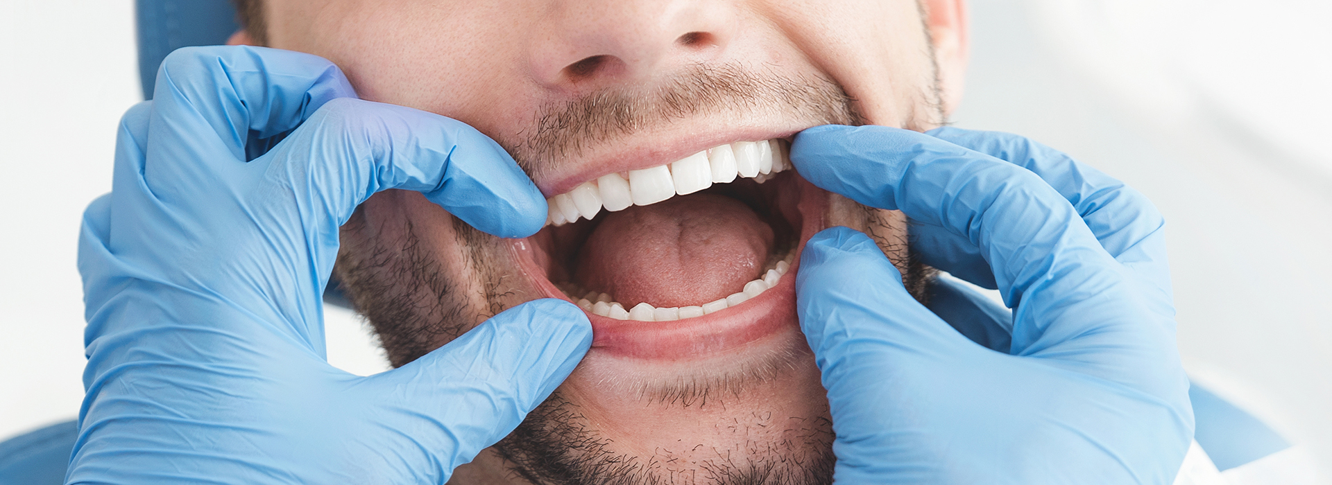 A dental hygienist wearing blue gloves and a surgical mask, holding up a patient s mouth with one hand while cleaning their teeth with the other.