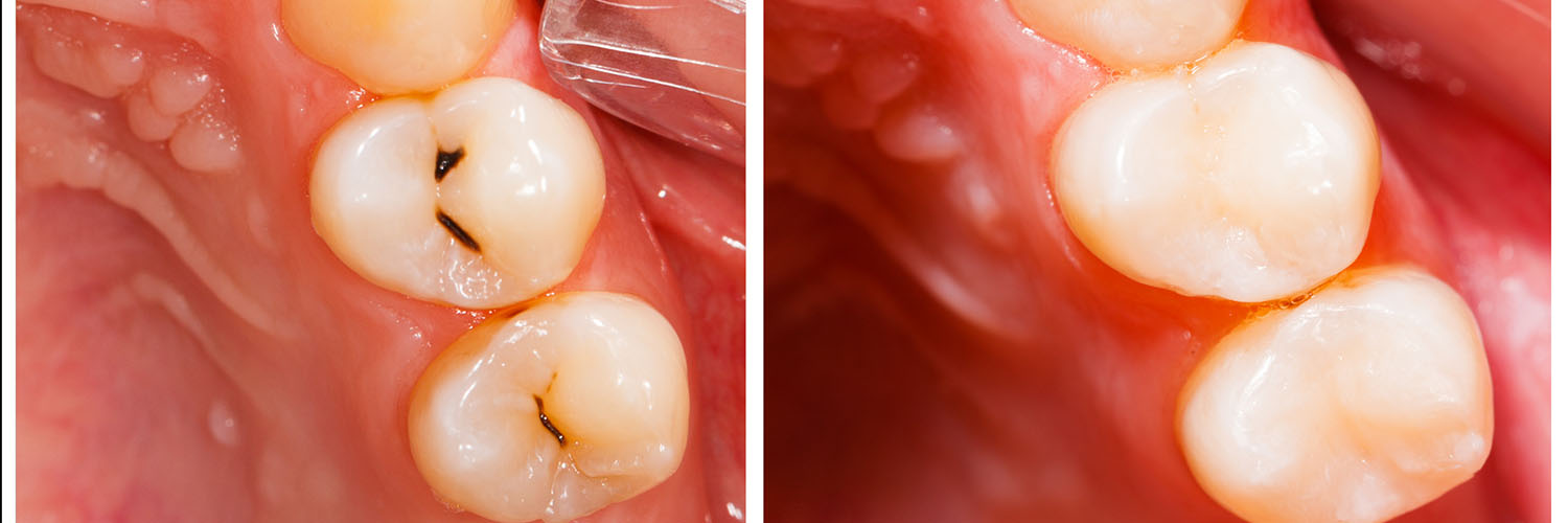 Mountain View Dentistry